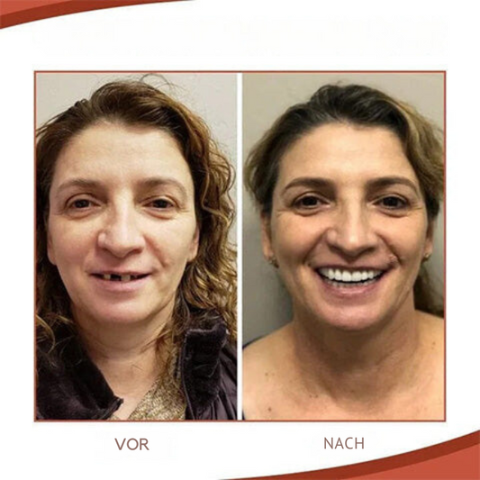 Bel Hills | Biocompatible Prosthesis Set for Pain-Free Fit and Natural Smile
